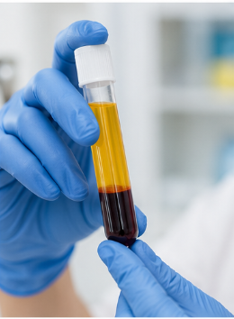 PRP skin rejuvenation treatment